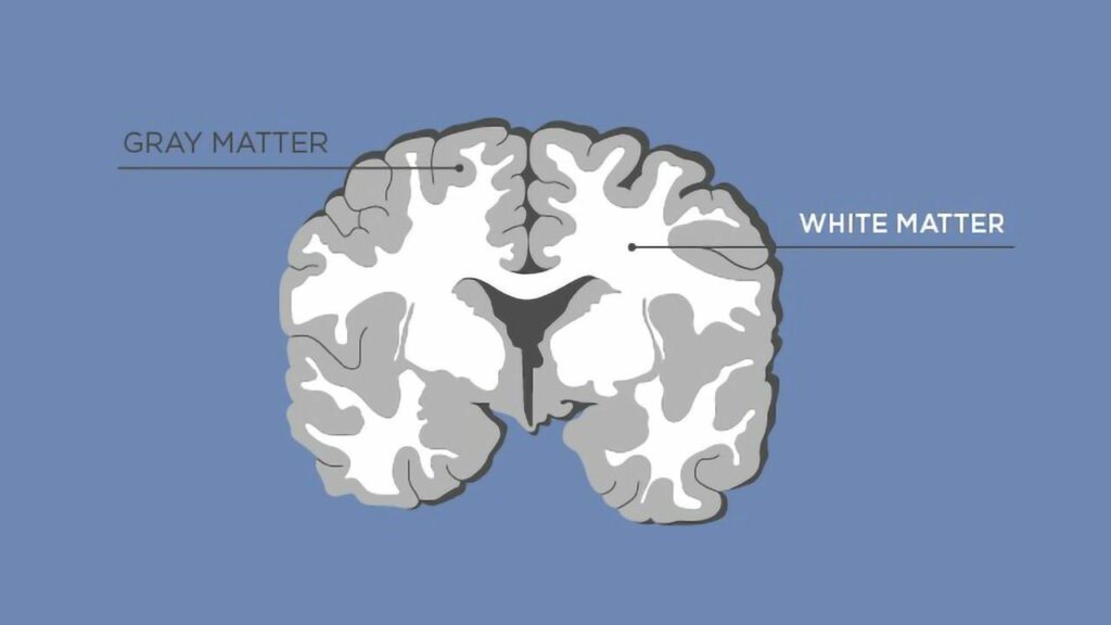 digital dementia and loss of gray matter